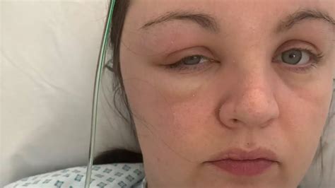 Image result for Embalming Mistakes