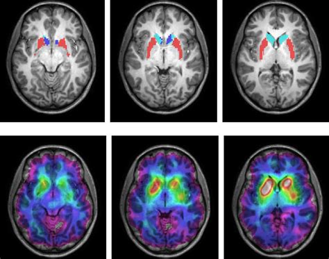 Image result for Artificial Intelligence Python Code