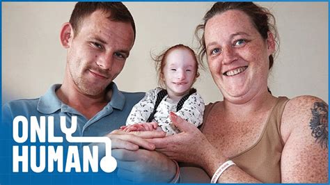 Image result for Dwarfed