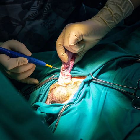 Image result for Testicles Surgery