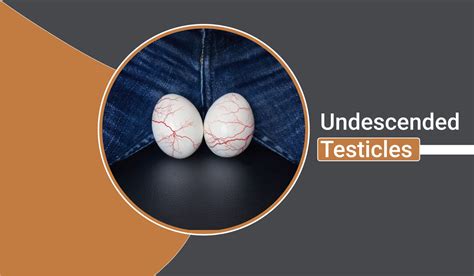 Image result for Testicles Surgery