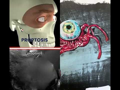 The eyeball alien painting that made me uncomfortable #artshortsform #scary