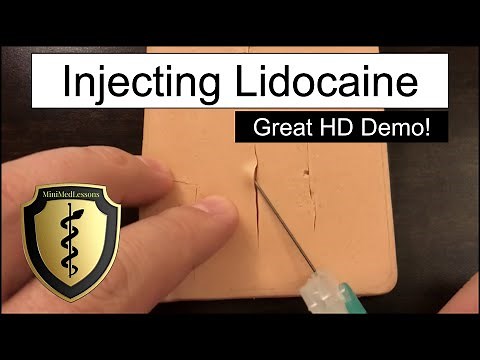 Injecting Lidocaine for a Laceration - HD Video Demonstration!