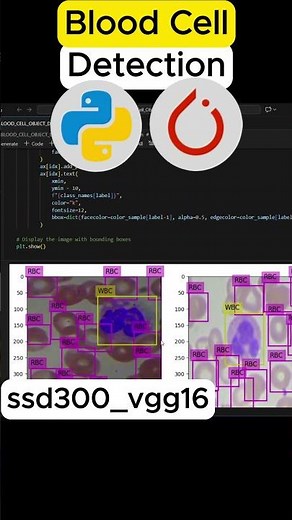 🩸 Blood Cell Detection using SSD & Transfer Learning! #computervision #coding #deeplearning #ai