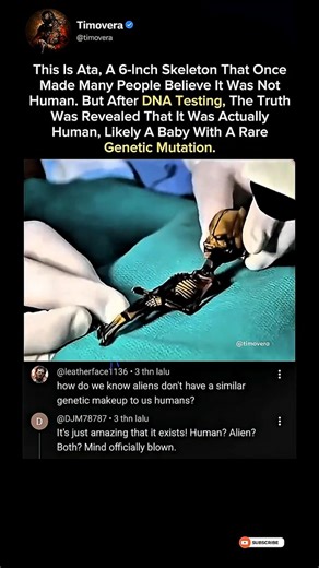 The Tiny Skeleton Mistaken For An Alien