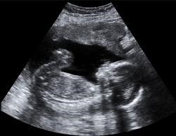 Why Doesn't a Pregnant Woman's Body Attack the Alien Fetus?