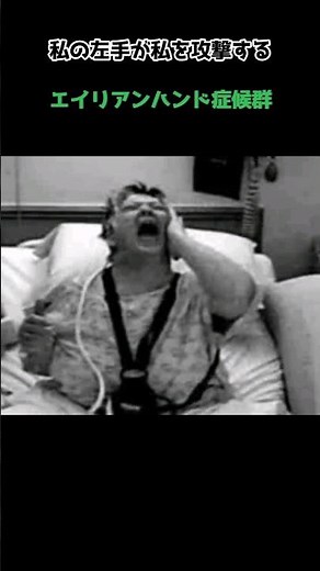 自分の手に襲われる!? #エイリアンハンド症候群 #他人の手症候群 #てんかん