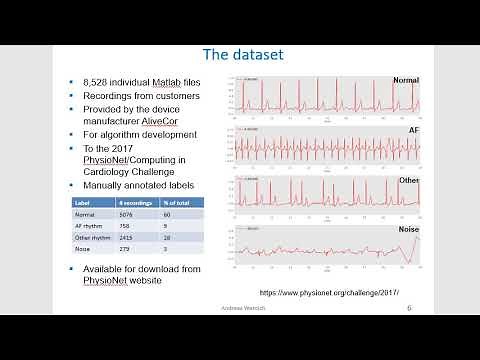 Convolutional neural network for ECG classification
