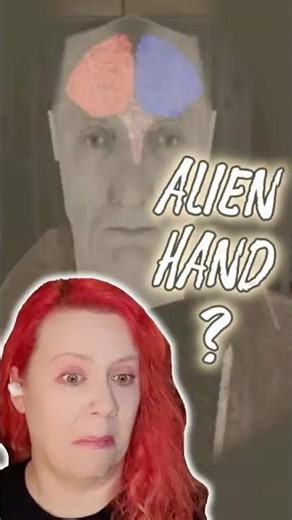 His Own Hand Keeps Sabotaging Him… | Alien Hand Syndrome