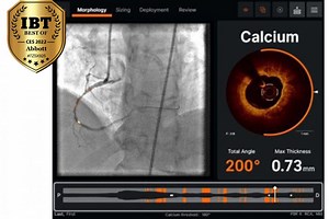 CES 2022: Ultreon 1.0 Software Revolutionizes Blood Clot Imaging