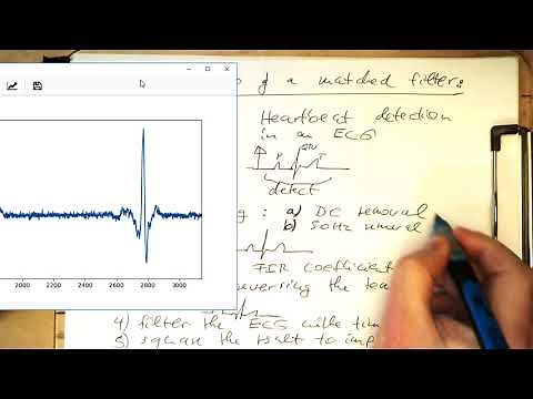 Matched filters: Python demo detecting heartbeats (Py)