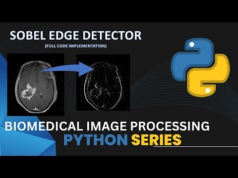 Sobel Edge detector |Python Code implementation | Image Processing |Computer vision