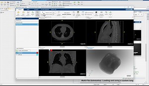 With MATLAB R2024a, the Medical Image Labeler app now integrates with Medical Open Network for AI (MONAI) Label for easier segmentation and labeling of organs and bones in both 2D and 3D radiological scans 🩻 Try the hands-on🖐️ experience here: http://spr.ly/6180ZFhvy #MATLAB #MedicalImaging #MONAI | MATLAB