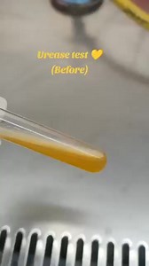 Urease test ❤️❤️ Positive and negative test. | Lab life