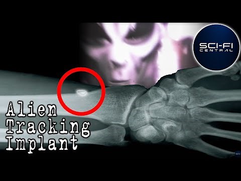 Alien Implants | Alien Mind Control | Weird Or What? | S3EP10 | William Shatner