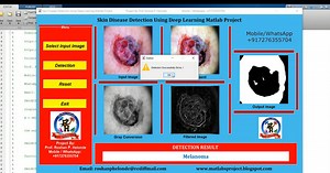 Skin Disease Detection Using Deep Learning CNN | Skin Disease Classification Using Matlab | Final Year Project With Source Code