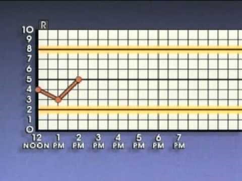 Statistical Process Control Basic Control Charts