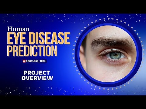 Human Eye Disease Prediction Introduction Part-1 | Image Classification Project | Project Overview