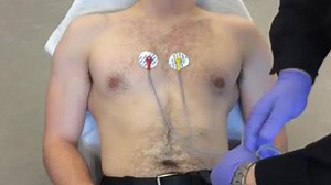 A simplified method for 12-lead ECG electrode placement