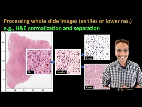267 - Processing whole slide images (as tiles)