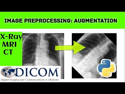Image preprocessing: how to do augmentation python programming ITFO