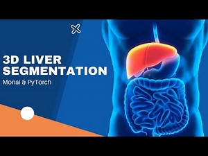 Automatic Liver Segmentation Using PyTorch and Monai