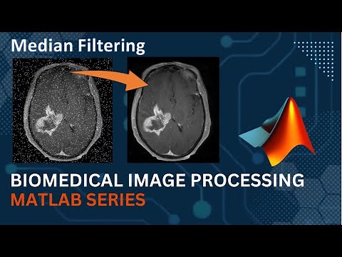 Median Filter || MATLAB Code Implementation || Medical Image Processing |Computer Vision
