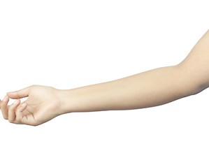 Guide to Arm Care After Breast Surgery and Lymph-Node Removal