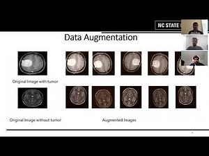 Brain Tumor Detection using Convolutional Neural Network