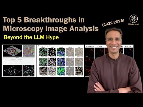 Top 5 Breakthroughs in Microscopy Image Analysis (377 )