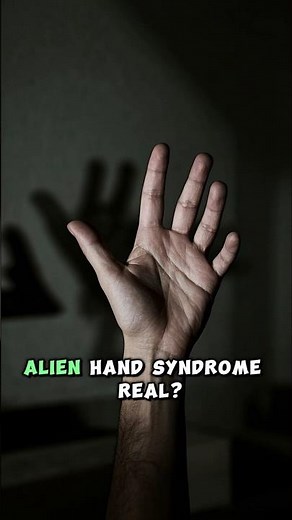 Alien Hand Syndrome: Real?