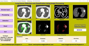 Matlab Code for Lung Cancer Detection Using Image Processing