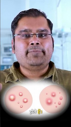 Scrotum Sebaceous Cyst EXPLAINED in 5 Minutes