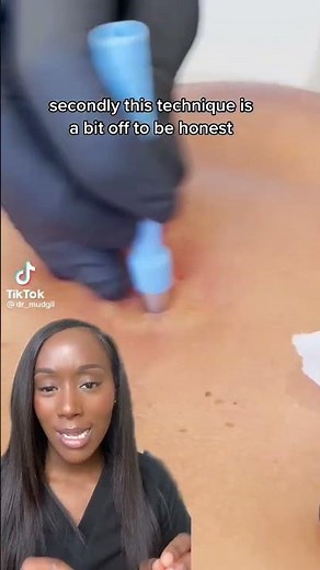 Punch Biopsy: A Comprehensive Guide to Understanding the Procedure