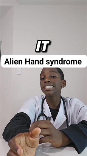 *Ever heard of Alien Hand Syndrome? 🖐️👽* It’s a rare neurological condition where a person’s hand seems to move on its own—without control. Imagine your hand unbuttoning your shirt or grabbing objects without you meaning to! It’s real, it’s rare, and it’s fascinating. Our brain is powerful—but when communication breaks, strange things happen. 🎥 Follow for more bizarre & rare medical facts! #AlienHandSyndrome #NeuroFacts #HealthAwareness #WeirdButReal #FacebookReels | Great the science kid