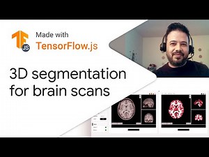 3D MRI brain segmentation - Made with TensorFlow.js