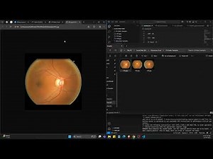 Deep Learning for Automated Glaucoma Detection | Multi-Modal Biomarker Fusion