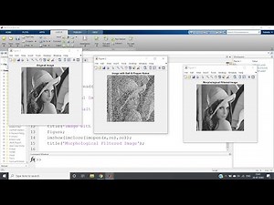 Morphological Filtering | Digital Image Processing | MATLAB