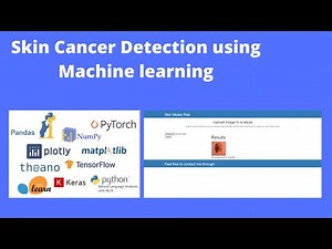 Skin Cancer Detection using Machine Learning with Source Code