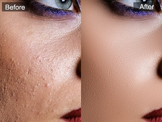 SkinFiner: Fastest portrait skin retouching software & plugin