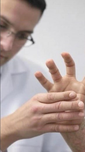 Alien Hand Syndrome: A rare disorder that causes a hand to move involuntarily part 3