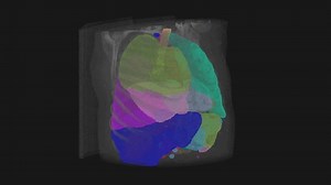 MATLAB | 🩻 Simplify Medical Image Segmentation in MATLAB – No Complex Coding Required! 📥 Import medical imaging data (DICOM, NIfTI, NRRD) 👀 View... | Instagram