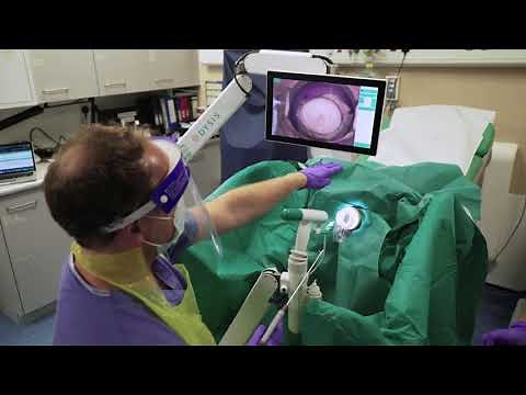 Cervical Rotating Biopsy Punch & LLETZlearn® Training Simulator in Conjunction with DYSIS Medical