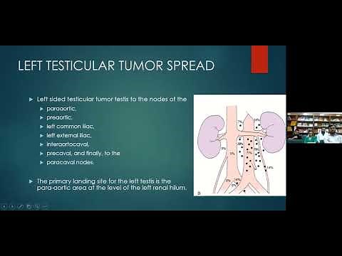 Retroperitoneal Lymph Node Dissection RPLND