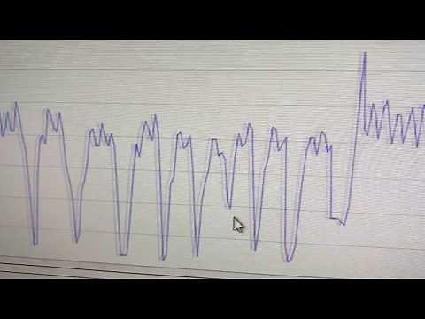 Trying out a pure-javascript WebSerial Plotter in Chrome