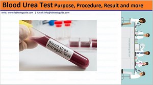 Blood Urea Test Purpose, Procedure, Result and more | Lab Tests Guide