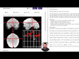 Exploring Open Source Brain MRI Data with Python | Building a 3D MRI Viewer Using Flask!