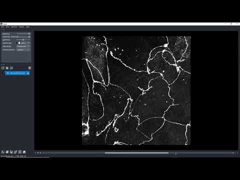 Learn the basics of Napari image viewer for Python