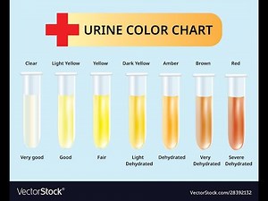 Urinalysis