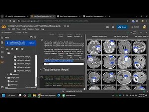 Brain Tumor Detection and Segmentation using YOLO and SAM